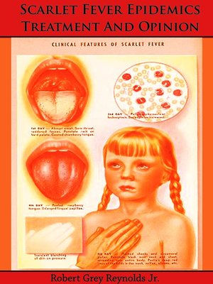 cover image of Scarlet Fever Epidemics Treatment and Opinion